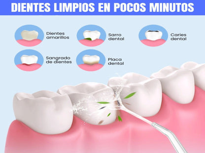 IRRIGADOR DENTAL